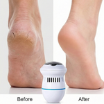 Pulidor De Callo Inalámbrico Raspa Callo